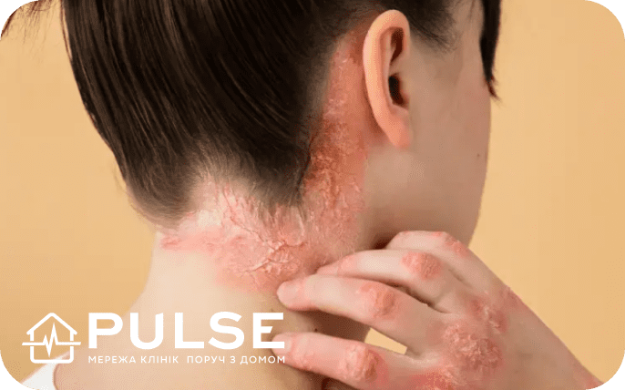 disease_img_2_mob