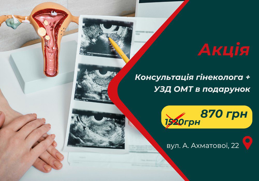 akcia_ahmatovoi